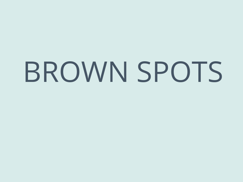 Brown Spots - Anne Therese - Gahanna and Lewis Center, Ohio